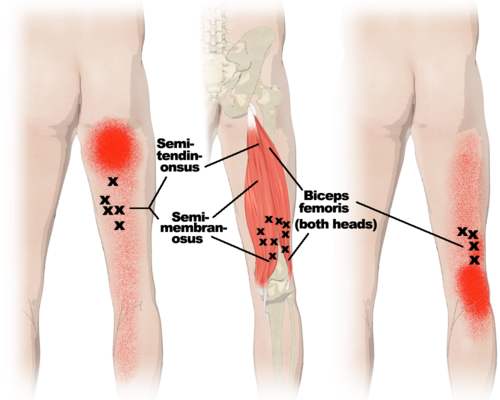 hamstrings-muscles-TP.png